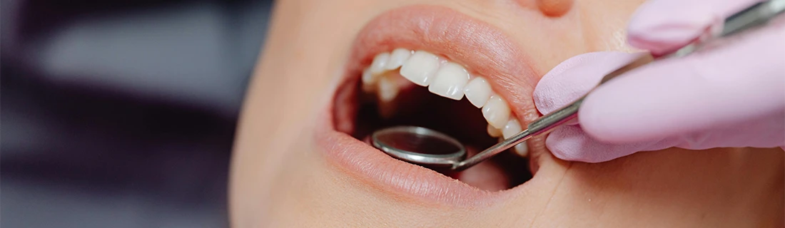 Why Do I Need Regular Teeth Cleanings In Lewiston ME?