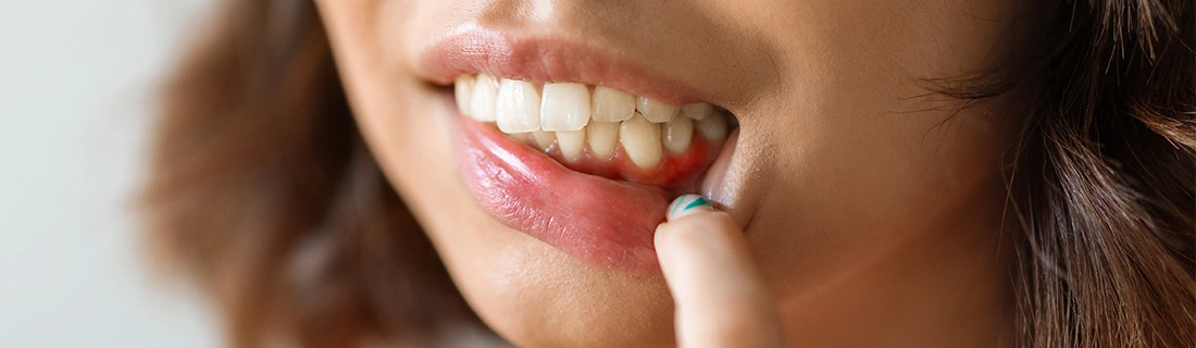 Oral Cancer Screenings In Lewiston ME